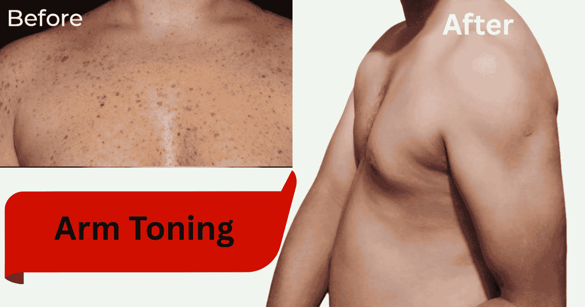 arms before and after toning